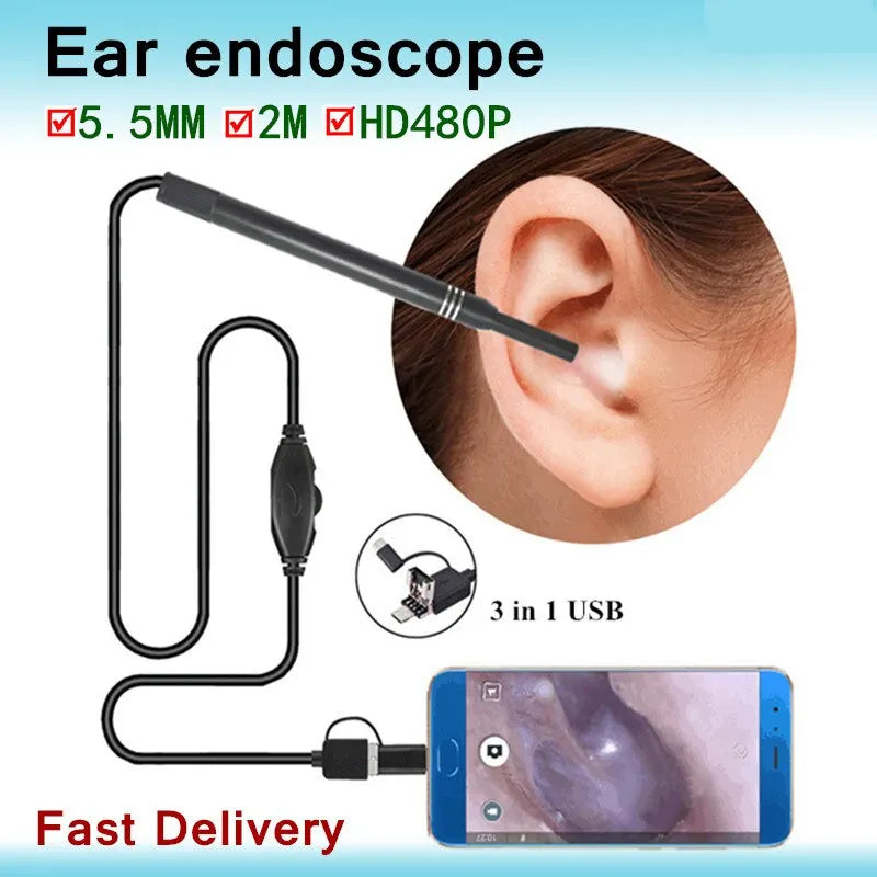 Ear Endoscope USB HD Mini Camera